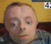 szok